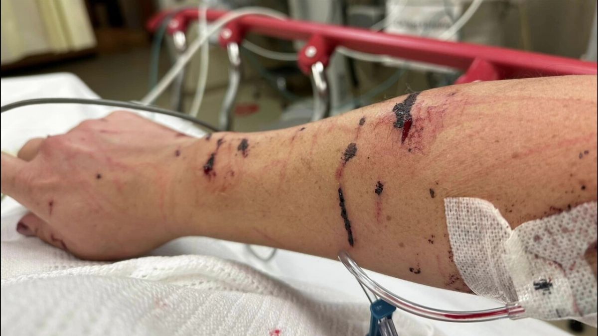 Jen Royce was attacked by otters in Montana