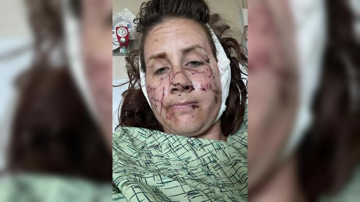 Jen Royce was attacked by otters in Montana